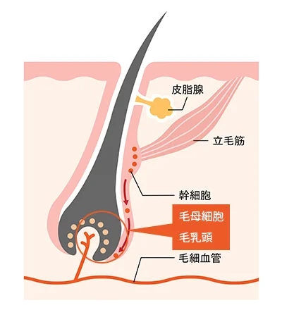毛根周辺組織（毛の細胞）を破壊