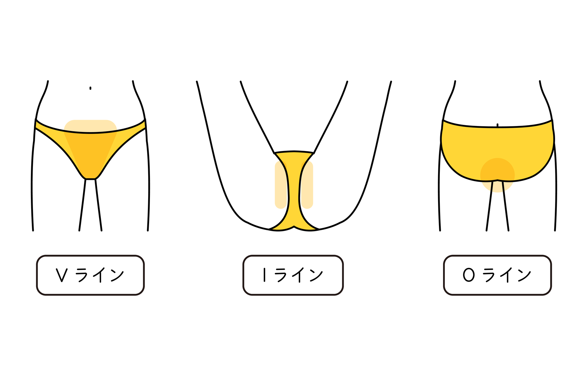 VIOの医療脱毛は痛い？　痛みを感じやすい理由やタイミング、脱毛時の痛みを軽くする方法を解説- 医療脱毛ならカノアクリニック